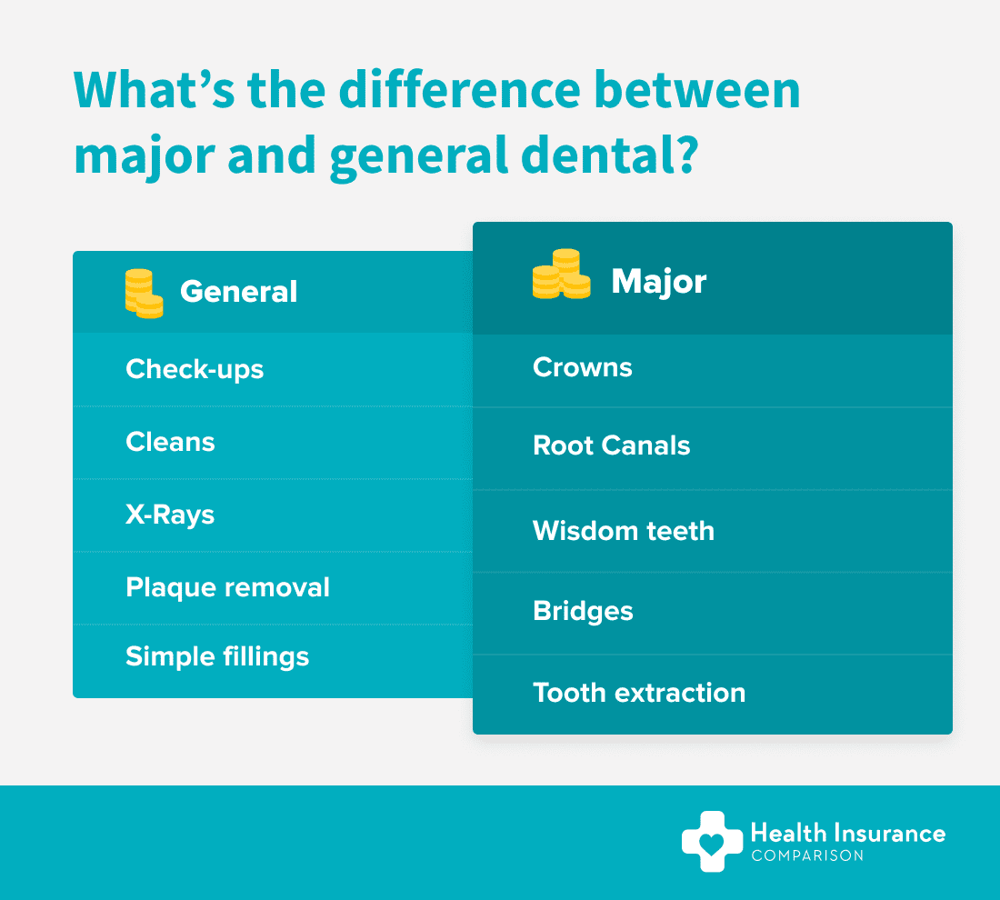 Dental Health Insurance in Australia How Does It Work? Dental Health Insurance in Australia How Does It Work?